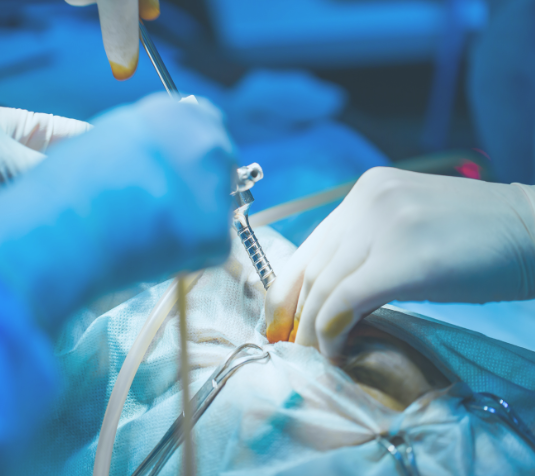 ENDOSCOPIA LAPAROSCOPIA
